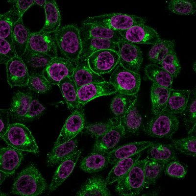 Beta-2 Microglobulin Monoclonal Mouse Antibody (BBM.1)