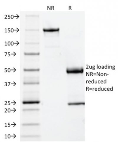 Beta-2 Microglobulin Monoclonal Mouse Antibody (BBM.1)
