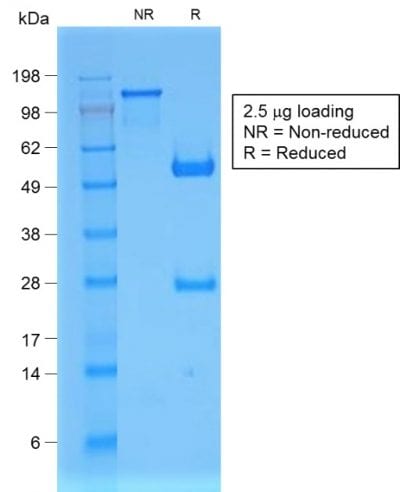 Beta-2 Microglobulin Recombinant Monoclonal Rabbit Antibody (B2M/1857R)