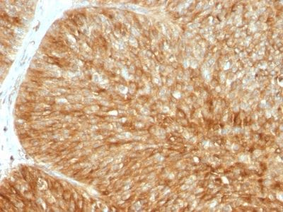 Beta-2 Microglobulin Recombinant Monoclonal Rabbit Antibody (B2M/1857R)