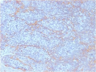 Beta-Catenin Monoclonal Mouse Antibody (CTNNB1/2098)
