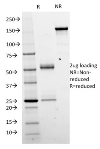 Beta-Catenin Monoclonal Mouse Antibody (CTNNB1/2098)