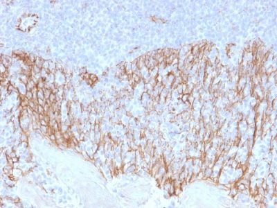 Beta-Catenin Monoclonal Mouse Antibody (CTNNB1/2099)