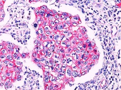 Beta-Catenin Polyclonal Rabbit Antibody (PAb)