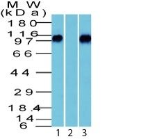Beta-Catenin Polyclonal Rabbit Antibody (PAb)