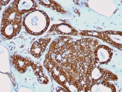 Beta-Catenin Recombinant Monoclonal Mouse Antibody (rCTNNB1/2173)