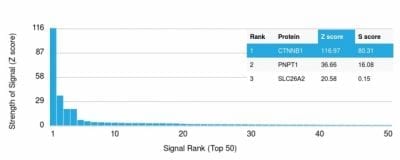 Beta-Catenin Recombinant Monoclonal Mouse Antibody (rCTNNB1/2173)