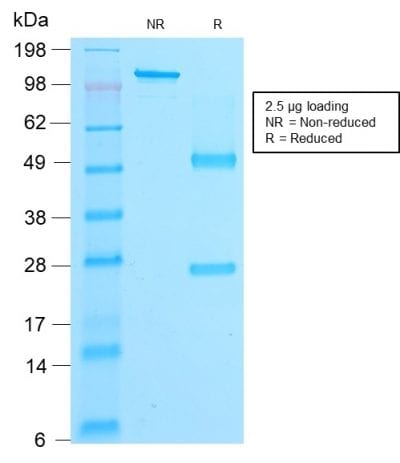 Beta-Catenin Recombinant Monoclonal Mouse Antibody (rCTNNB1/2173)