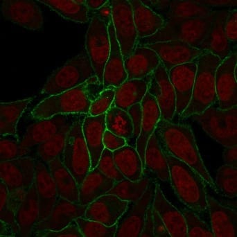 Beta-Catenin Recombinant Monoclonal Mouse Antibody (rCTNNB1/2173)