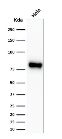 Beta-Catenin Recombinant Monoclonal Rabbit Antibody (CTNNB1/2030R)