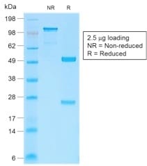 Beta-Catenin Recombinant Monoclonal Rabbit Antibody (CTNNB1/2030R)