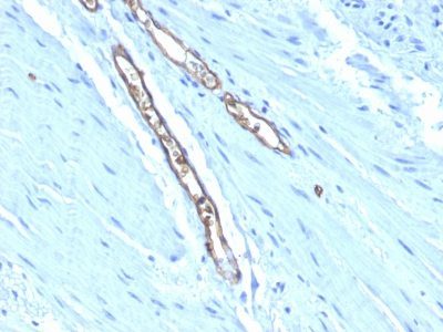 Blood Group A & Forssman Antigen Monoclonal Mouse Antibody (HE-193)