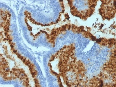 Blood Group B Monoclonal Mouse Antibody (HEB-20)