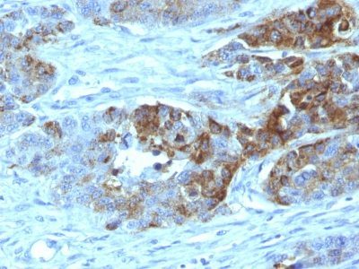 Blood Group H Type 2 Monoclonal Mouse Antibody (19-OLE)