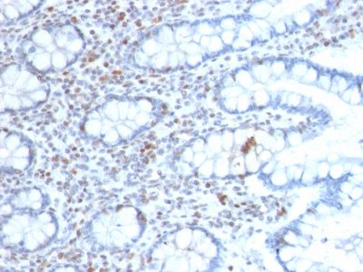 BMI1 Monoclonal Mouse Antibody (BMI1/2689)