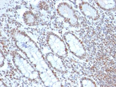 BMI1 Monoclonal Mouse Antibody (BMI1/2690)