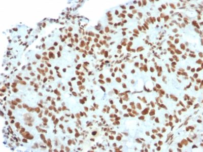 BMI1 Monoclonal Mouse Antibody (BMI1/2823)