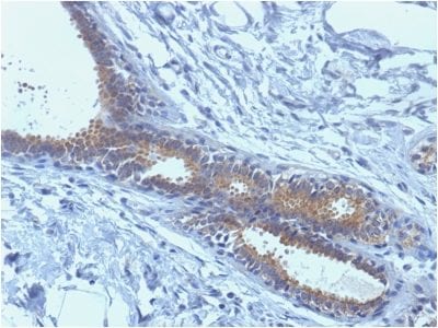 BRCA1 Monoclonal Mouse Antibody (BRCA1/1398)
