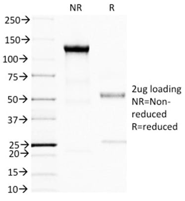 BRCA1 Monoclonal Mouse Antibody (BRCA1/1398)