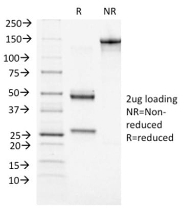 BRCA1 Monoclonal Mouse Antibody (BRCA1/1472)