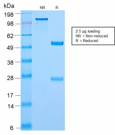 c-Myc (EQKLISEEDL) Recombinant Monoclonal Rabbit Antibody (MYC2895R)