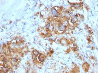 CA19-9 / Sialyl-Lewis A Monoclonal Mouse Antibody (121SLE)