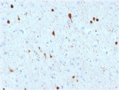Calretinin / Calbindin 2 Monoclonal Mouse Antibody (CALB2/2602)
