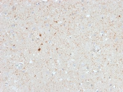 Calretinin / Calbindin 2 Monoclonal Mouse Antibody (CALB2/2603)