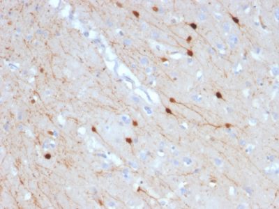 Calretinin / Calbindin 2 Monoclonal Mouse Antibody (CALB2/2685)