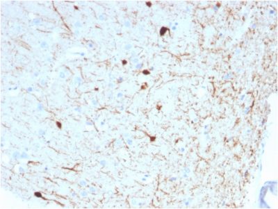Calretinin / Calbindin 2 Monoclonal Mouse Antibody (CALB2/2786)
