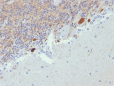 Calretinin / Calbindin 2 Monoclonal Mouse Antibody (CALB2/2807)