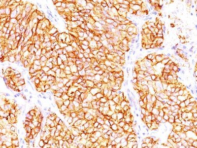 Carbonic Anhydrase IX / gp200 Monoclonal Mouse Antibody (66.4.C2)