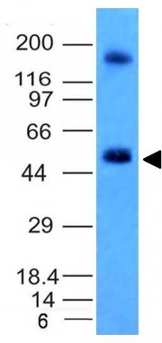 Carbonic Anhydrase IX / gp200 Monoclonal Mouse Antibody (CA9/781)