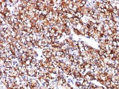 Carbonic Anhydrase IX / gp200 Monoclonal Mouse Antibody (CA9/781)