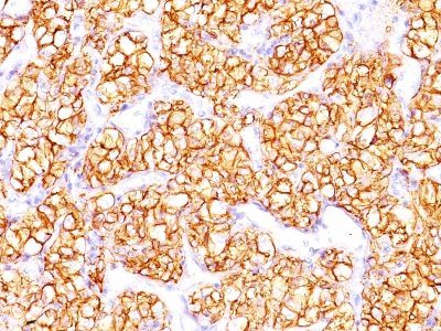Carbonic Anhydrase IX / gp200 Monoclonal Mouse Antibody (PN-15)