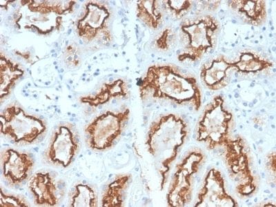 Carbonic Anhydrase IX / gp200 Recombinant Monoclonal Rabbit Antibody (CA9/2993R)