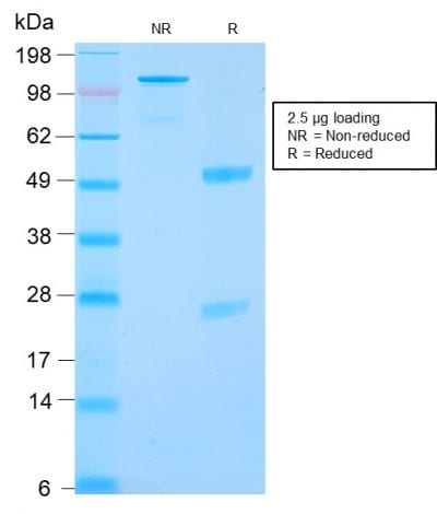 Carbonic Anhydrase IX / gp200 Recombinant Monoclonal Rabbit Antibody (CA9/2993R)