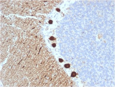 Carbonic Anhydrase VIII Monoclonal Mouse Antibody (CPTC-CA8-2)