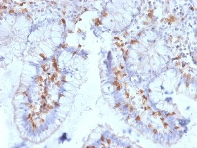 CD103 / Integrin alpha E Monoclonal Mouse Antibody (ITGAE/2063)