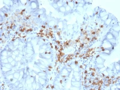CD103 / Integrin alpha E Monoclonal Mouse Antibody (ITGAE/2063)