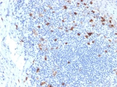 CD103 / Integrin alpha E Monoclonal Mouse Antibody (ITGAE/2063)