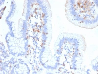 CD103 / Integrin alpha E Monoclonal Mouse Antibody (ITGAE/2474)
