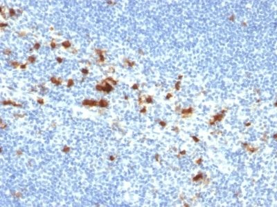 CD103 / Integrin alpha E Monoclonal Mouse Antibody (ITGAE/2474)