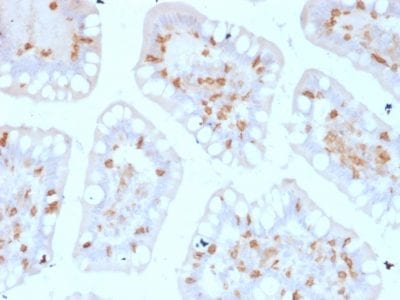 CD103 / Integrin alpha E Monoclonal Mouse Antibody (ITGAE/2474)