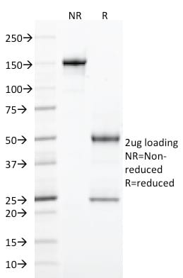 CD103 / Integrin alpha E Monoclonal Mouse Antibody (ITGAE/2474)