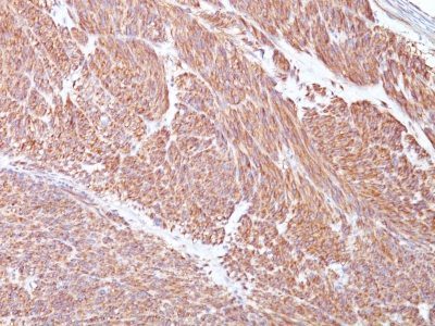 CD117 / c-Kit Monoclonal Mouse Antibody (Cocktail)