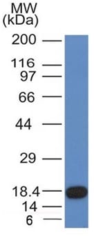 CD117 / c-Kit Monoclonal Mouse Antibody (KIT/982)