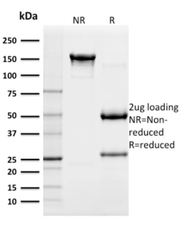 CD117 / c-Kit Monoclonal Mouse Antibody (KIT/982)