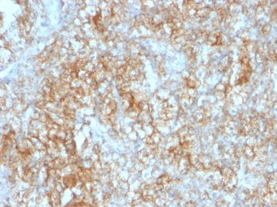 CD147 Monoclonal Mouse Antibody (8D6)