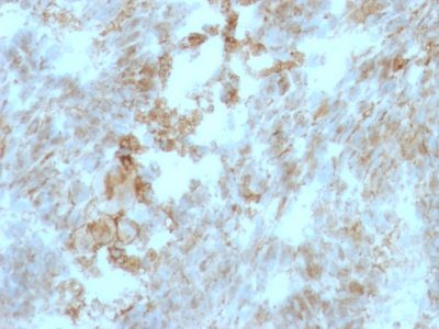 CD147 Monoclonal Mouse Antibody (BSG/963)